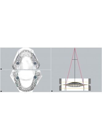 Ортодонтическое программное обеспечение ORTHODONTIC AXIOSCOPY