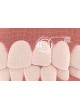 Программное обеспечение для ортодонтии Dental Monitoring ™ оптом