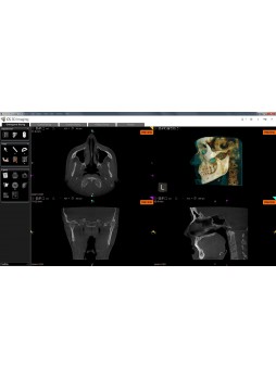 Программное обеспечение для обработки снимков зубов CS 3D