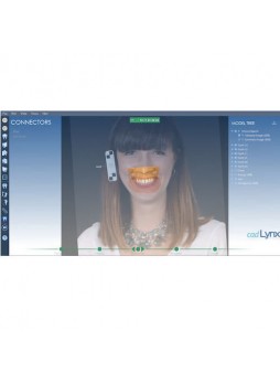 Программное обеспечение для создания цифровой улыбки SMILE LYNX SMILE DESIGN