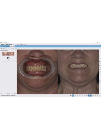 Программное обеспечение для стоматологии Digital Mockup