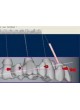 Программное обеспечение для стоматологии iCAM V5