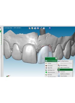 Программное обеспечение для стоматологии Straumann® CARES®