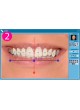 Программное обеспечение для стоматологии Planmeca Romexis Smile Design оптом