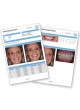 Программное обеспечение для стоматологии Planmeca Romexis Smile Design оптом