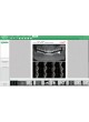 Программное обеспечение для стоматологии Ez3D-i