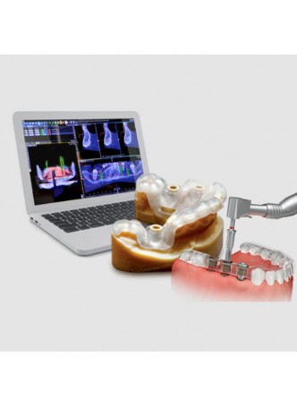Программное обеспечение для управляемой хирургии Implant3D оптом