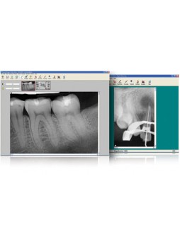 Программное обеспечение DICOM-файла CDR DICOM 5