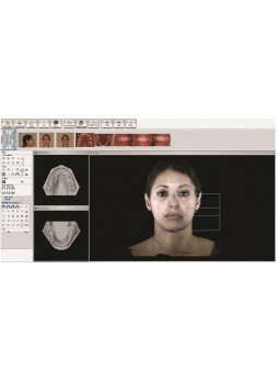 Стоматологический 3D-сканер Facial Insight 3D