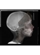 Стоматологический 3D-сканер Facial Insight 3D оптом