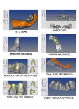 Стоматологический 3D-сканер Dentcad