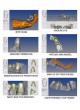 Стоматологический 3D-сканер Dentcad