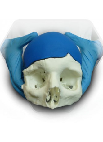 Черепной имплантат на заказ SkullPT оптом