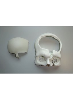 Черепной имплантат на заказ SkullPT