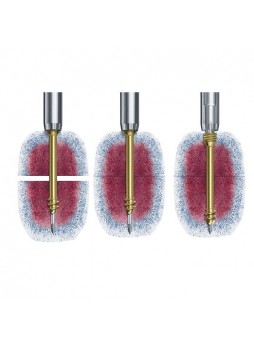 Общий компрессирующий винт для кости HCS 4.5, 6.5