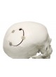 Система фиксации костного лоскута нерассасывающаяся Cranial LOOP оптом