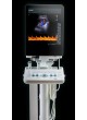 Ультразвуковой сканер на платформе, компактный bk3000