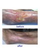 Лазер для фотостимуляции PHYSIOLASER OLYMPIC оптом