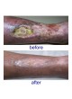 Лазер для фотостимуляции PHYSIOLASER OLYMPIC оптом