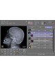 Система сбора данных для медицинских изображений для ветеринарной радиографии Leonardo DR mini II, Leonardo DR nano