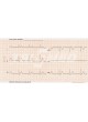 Ветеринарная ЭКГ-система 6 каналов CARDIPIA 400H оптом
