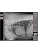 Ветеринарная рентгенографическая система Amadeo V